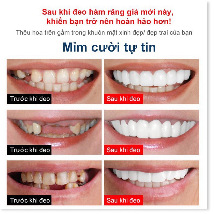 Hàm răng giả bằng silicon làm đẹp  - King's Garden