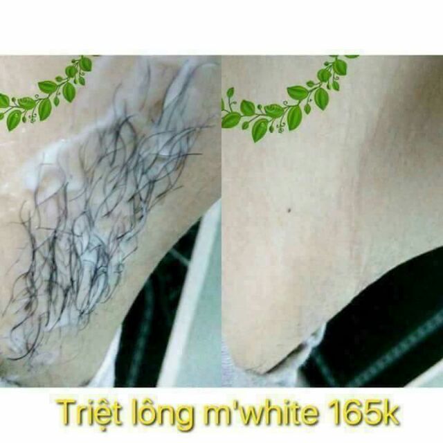 TRIỆT LÔNG TẨY LÔNG MWHITE CHÍNH HÃNG | BigBuy360 - bigbuy360.vn