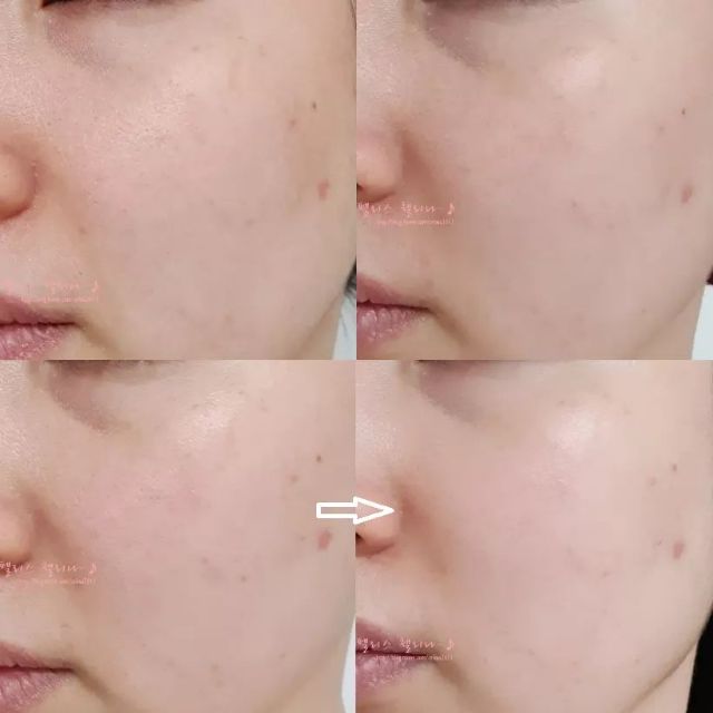 Tinh Chất Dưỡng Trắng, Chống Lão Hóa Nuôi Dưỡng Sáng Mịn Từ Bên Trong Some By Mi Galactomyces Pure Vitamin C Glow Serum