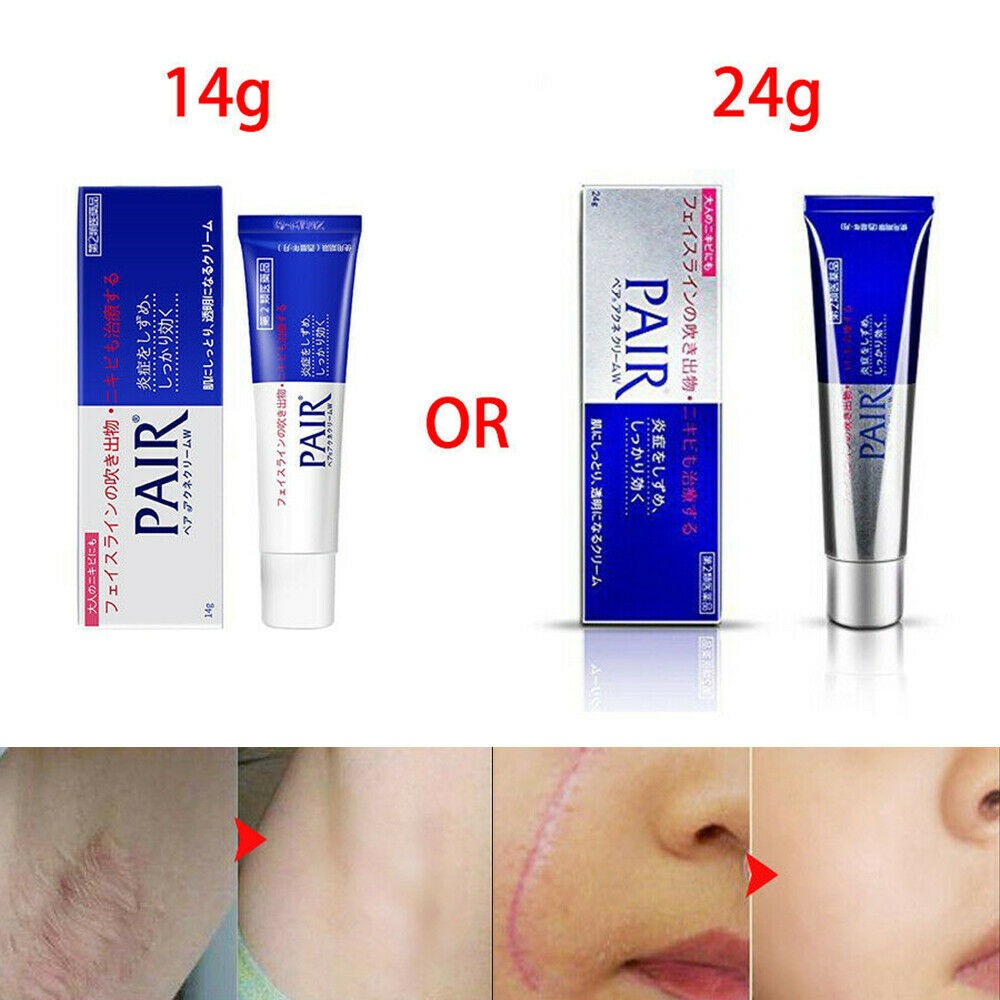 Kem giảm mụn Pair Acne Nhật bản 24gr