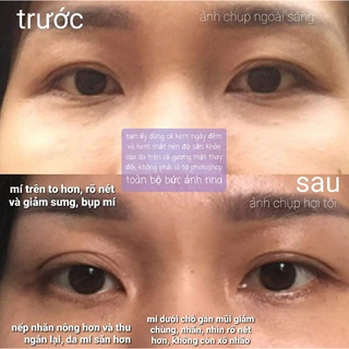 Kem Mắt Kha Tử