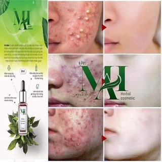 [ Chính hãng] SỮA RỬA MẶT DR MAI mẫu mới 2024