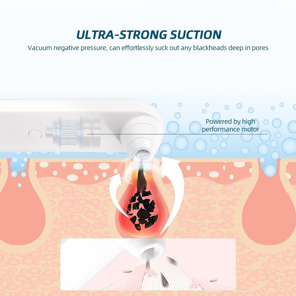 Máy hút mụn đầu đen FOREVERLILY làm sạch lỗ chân lông chăm sóc da mặt