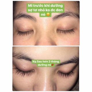 Dưỡng mi [Hàng order Thái Lan]