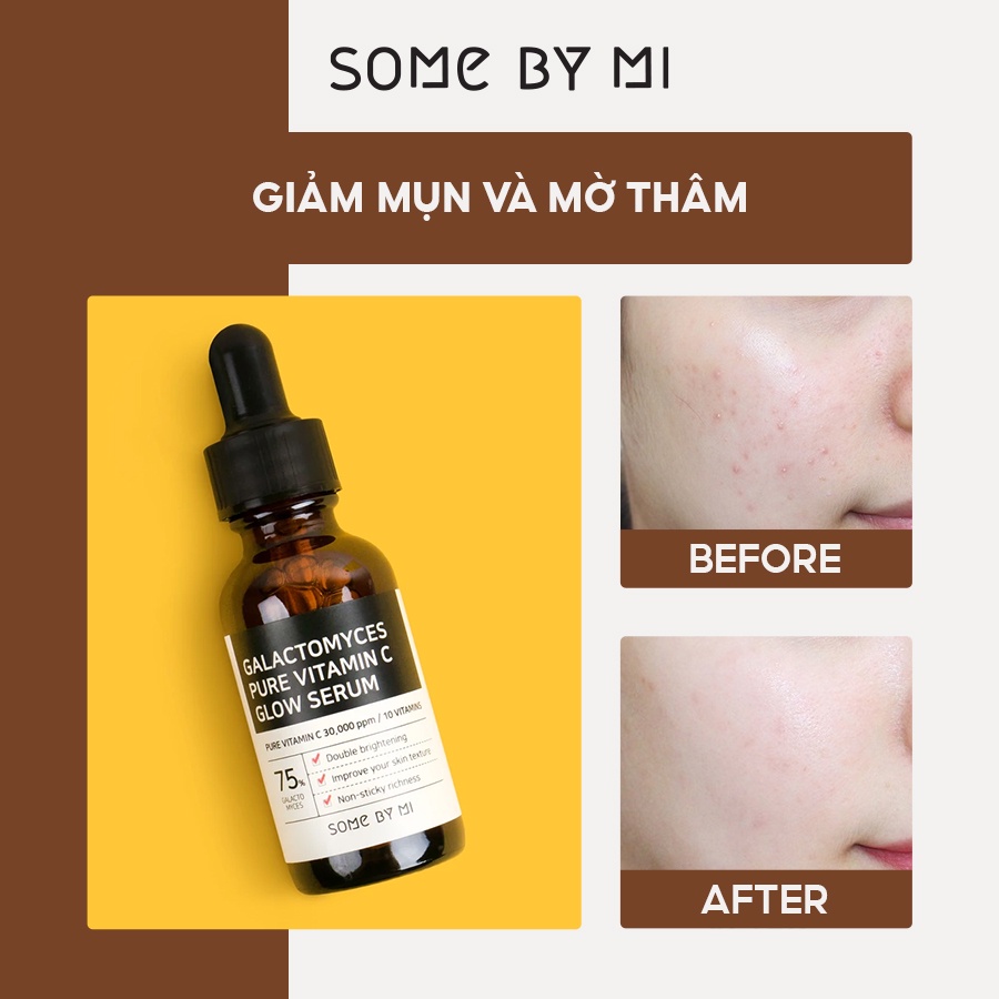 [Mã FMCGMALL -8% đơn 250K] Tinh Chất Dưỡng Trắng Chống Lão Hóa Some By Mi Galactomyces Pure Vitamin C Glow Serum 30ml