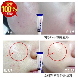 KEM MỤN MEDI PEEL CENTELLA 30ML [CHÍNH HÃNG]