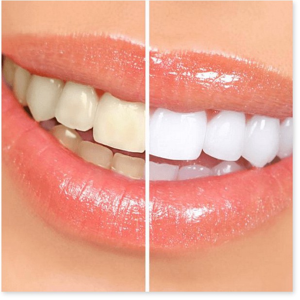 [Mã giảm giá mỹ phẩm chính hãng] Kem Đánh Răng Crest 3D White Advanced Whitening 158g