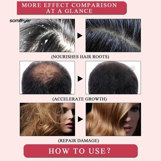 Tinh dầu chăm sóc tóc kích mọc tóc hiệu quả