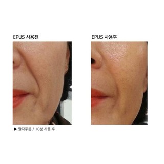 Kem dưỡng Dermafirm - Whitening Active Cream