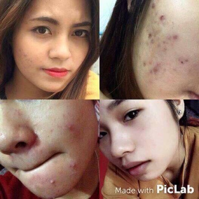 Kem Pair Nhật Bản
