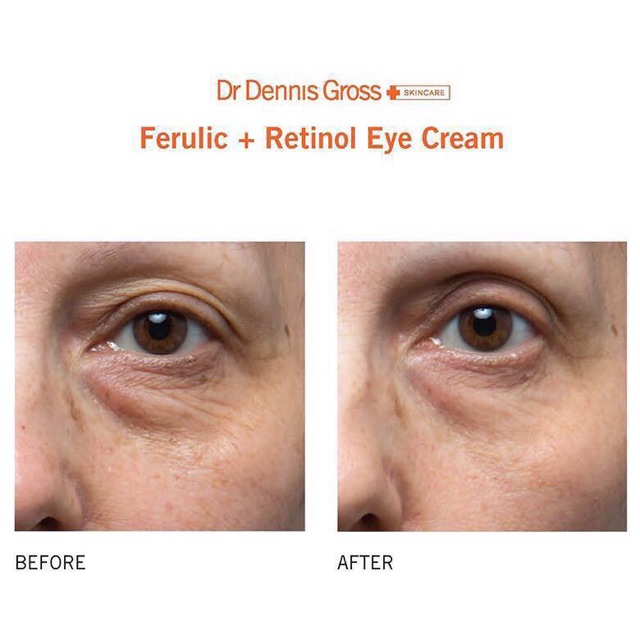 Serum dưỡng mắt Dr. Dennis Gross Ferulic + Retinol Triple Corection Eye Serum | BigBuy360 - bigbuy360.vn