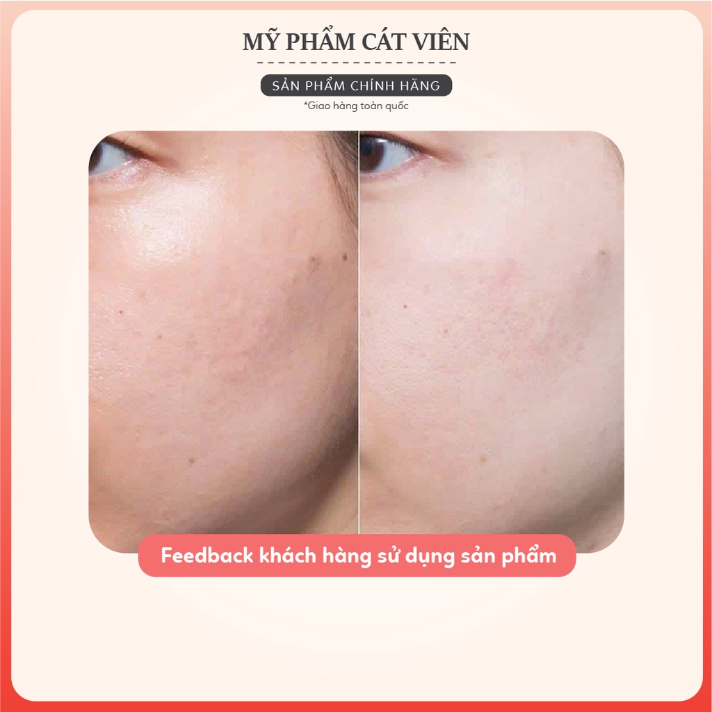 Kem dưỡng ẩm Hyalogy Moisture Mela Gel Rien'A - căng bóng, chăm sóc da hư tổn, cải thiện lão hóa - Hũ 50g