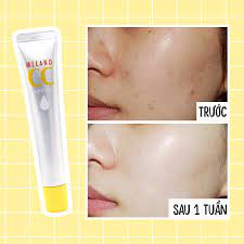 Serum Vitamin C Melano CC Rohto giảm thâm nám | BigBuy360 - bigbuy360.vn