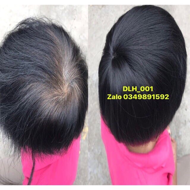 TÓC GIẢ CHE HÓI 15cm DLH_001