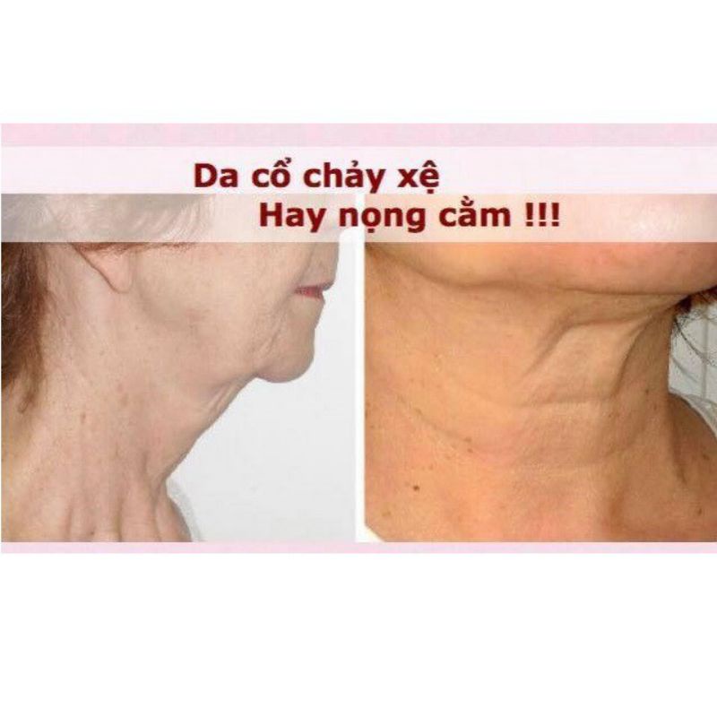 Kem novosit nâng cằm cổ chống chảy sệ của nga 50 ml
