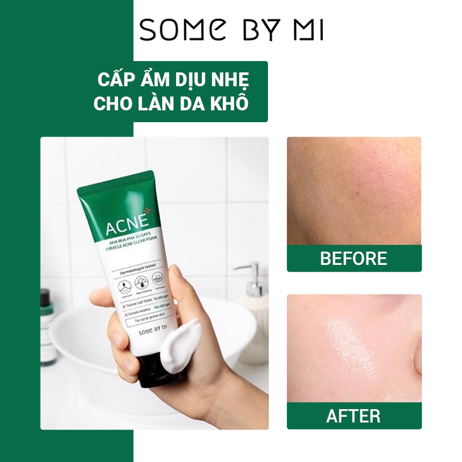 Sữa Rửa Mặt Some By Mi AHA.BHA.PHA 30 Days Miracle Cleansing Foam 100ml