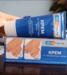 Kem trị đồi mồi nga