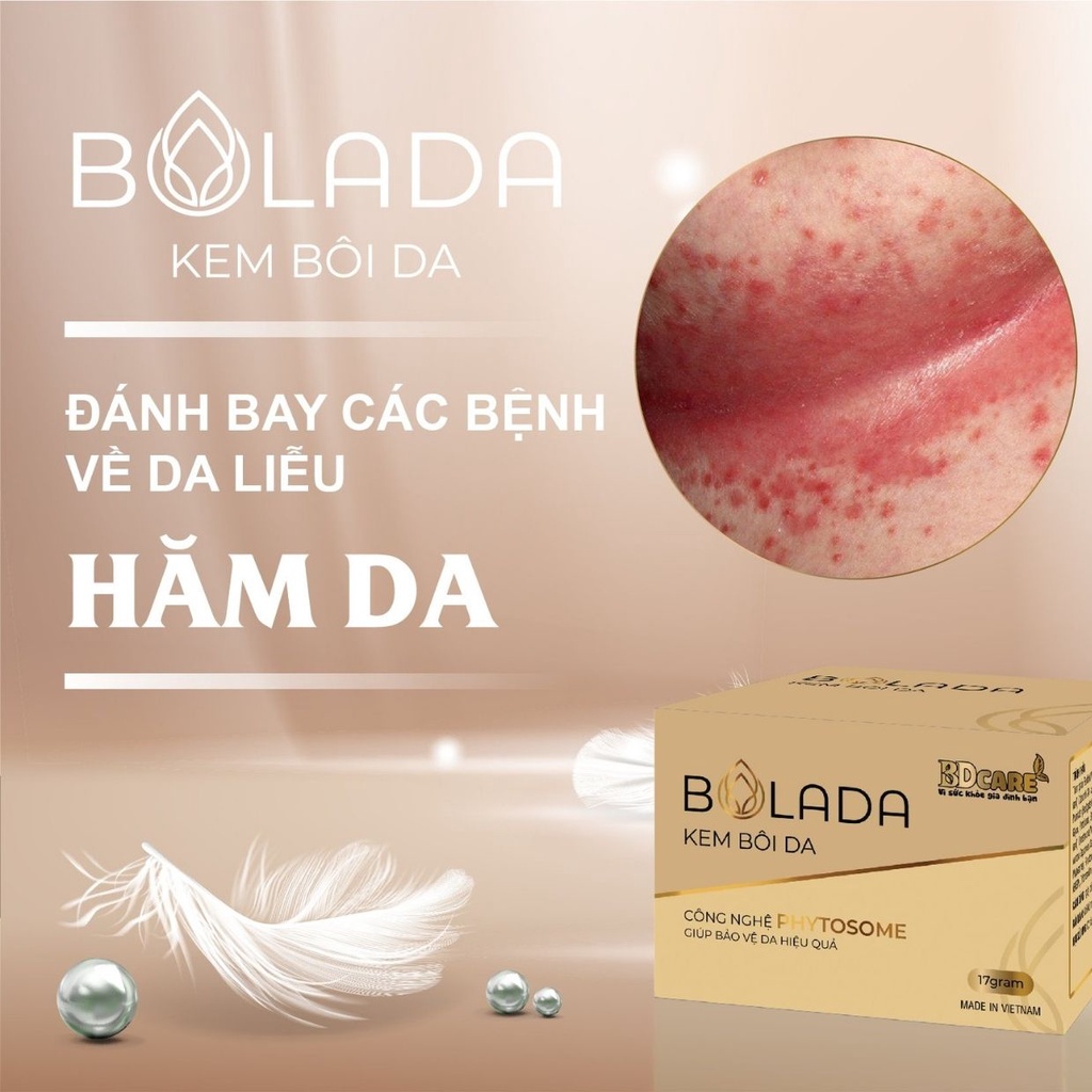 Kem bôi da Bolada phòng ngữa các bệnh ngoài da ngăn ngừa và loại bỏ các loại nấm trên da