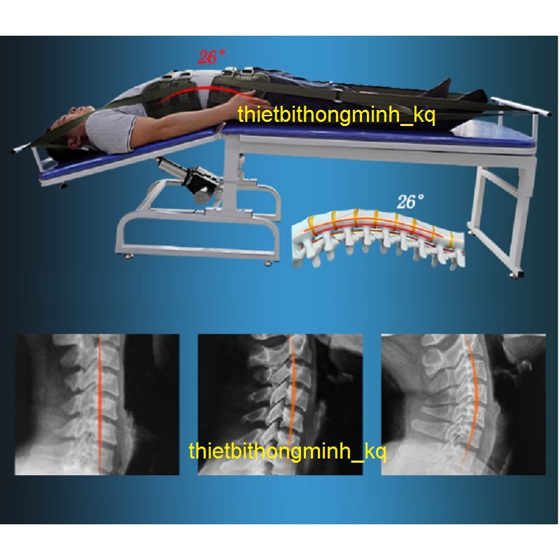 Giường kéo giãn cột sống lưng, cổ,toàn thân bằng điện 3 chiều 2 môtơ A999