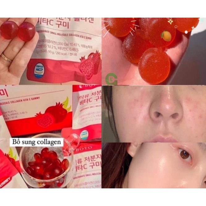 Kẹo Dẻo Collagen Hàn Quốc Vị Lựu Dưỡng Da Sáng Mịn- Boto Collagen Gummy