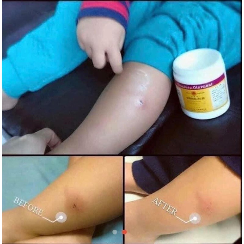 Kem bôi lành vết thương Oronine Ointment 100g