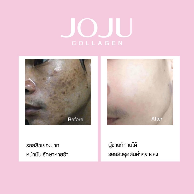 Viên uống duỡng da sáng khoẻ JOJU Collagen