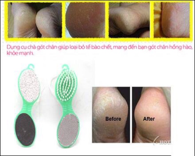 Đá bọt biển chà gót chân tẩy tế bào chết 4 in 1
