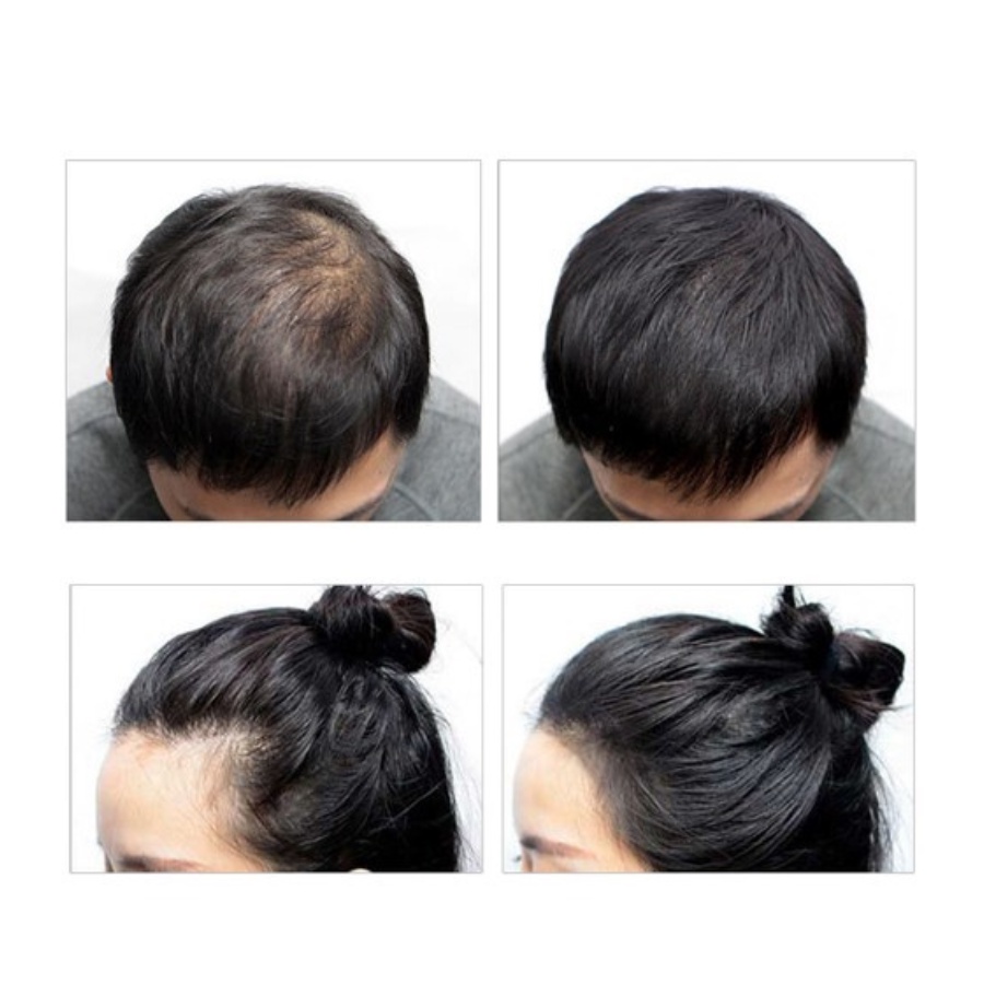 Phấn che khuyết điểm hàng ngày cho tóc, ngăn rụng tóc Dashu 16g, 26g