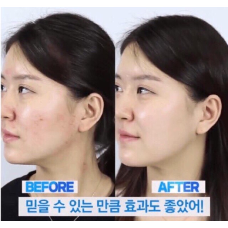 Tinh Chất Dưỡng Da Chiết Xuất Rau Má Skin1004 Madagascar Centella Asiatica 100 Ampoule