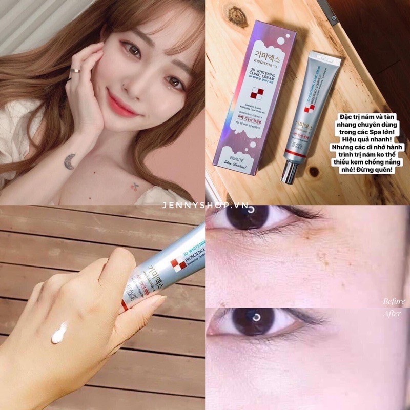 Kem Ngừa Nám Và Tàn Nhang Melasma-X 3D Whitening Clinic Cream