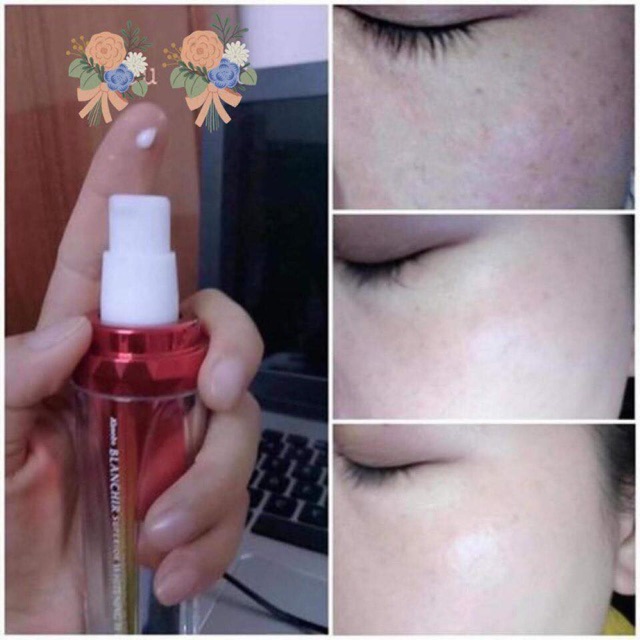 TINH CHẤT TẨY ĐỐM NÂU, TÀN NHANG BLANCHIR 45ml