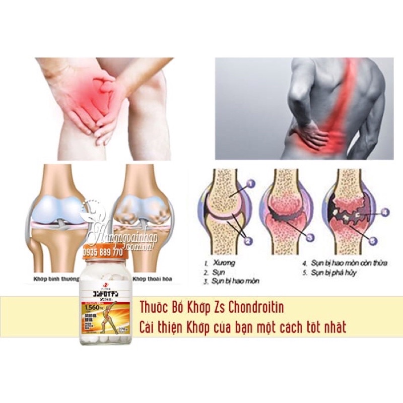 Viên uống hỗ trợ xương khớp nhện Zs Chondroitin Nhật Bản 180 và 270 Viên