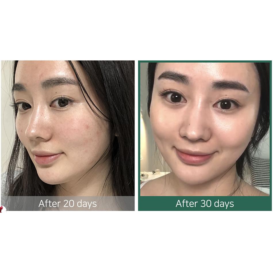 Nước hoa hồng Toner Some by Mi AHA BHA PHA 30 DAYS