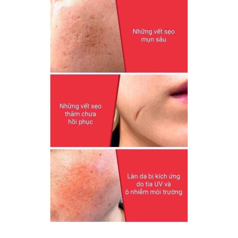 Tinh Chất Dưỡng Phục Hồi, Cải Thiện Vết Thâm, Sẹo, Làm Dịu Da Some By Mi Snail Truecica Miracle Repair Serum