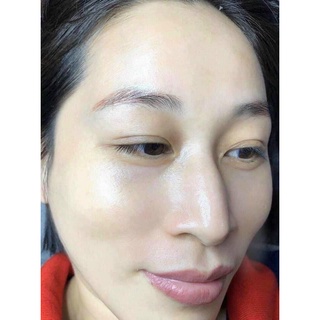 Kem hút nám dùng cho spa( Kem D: Ức chế nám sâu)