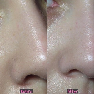 Tẩy da chết Cosrx BHA