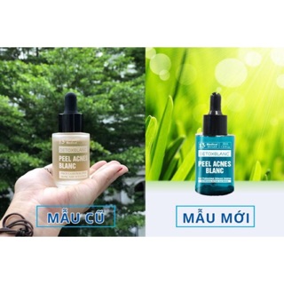 Serum trị mụn feel detox blanc