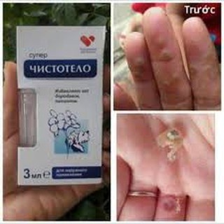 Gel xóa ruồi , mụn cóc , mụn thịt
