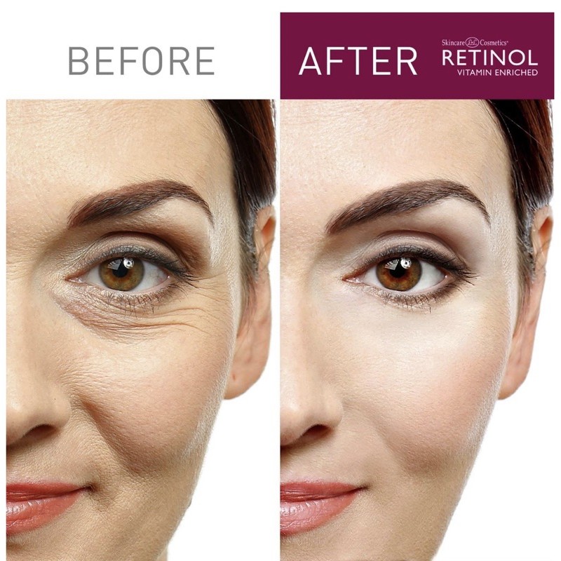 SỮA RỬA MẶT RETINOL VITAMIN ENRICHED ANTI-AGING GEL CLEANSER 150 ML - 5 FL OZ