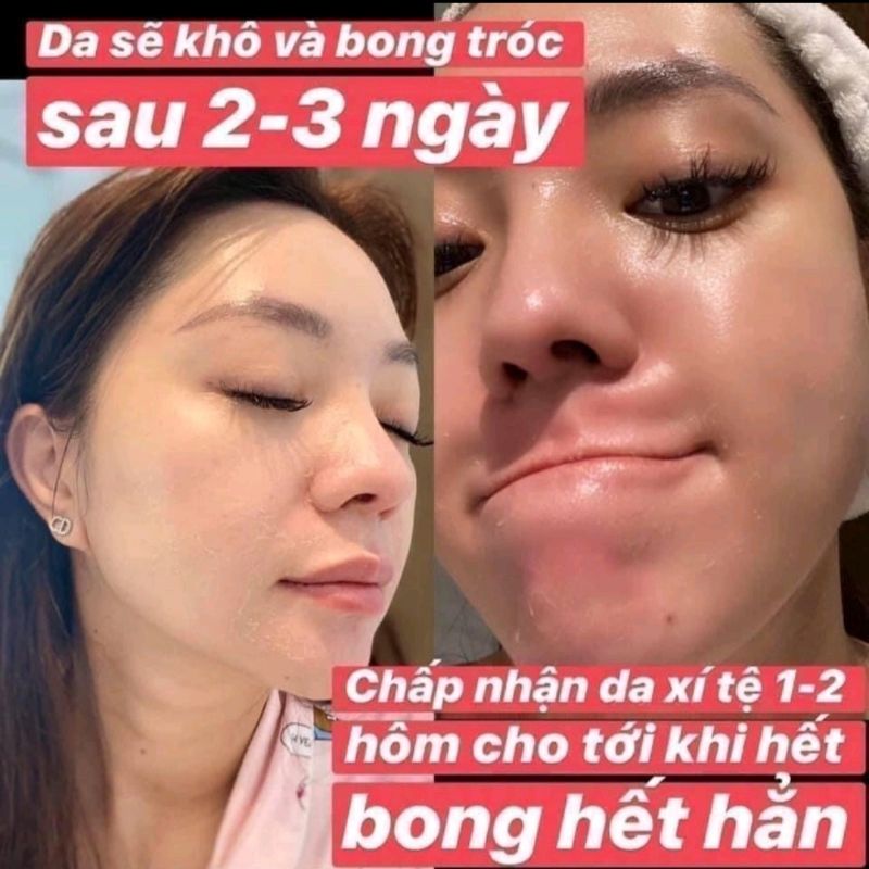 PEEL Da sinh Học tại nhà Neostrata PROCYSTEM RETINOL PEEL, thay da tại nhà Neostrata [ chính hãng ]