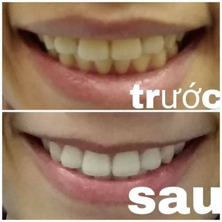 Bột Than Tre Trắng Răng Tanoshi