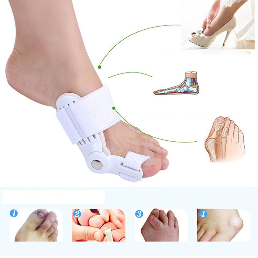 Dây Bản Lề Chỉnh Hình Ngón Chân Cái Chuyên Dụng Cho Spa