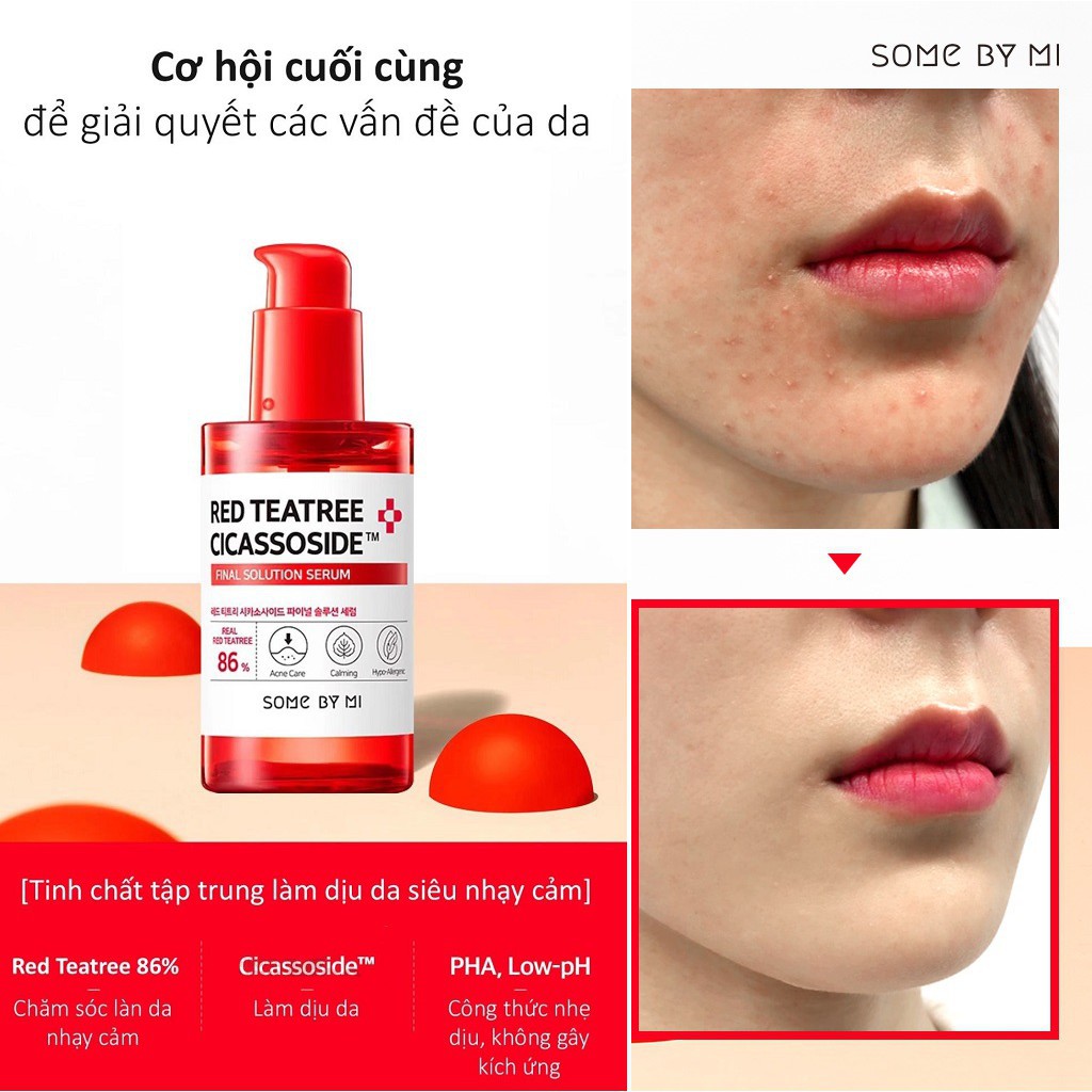 Tinh Chất Cho Da Siêu Nhạy Cảm Chiết Xuất Tràm Trà Đỏ Some By Mi Red Teatree Cicassoside Final Solution Serum 50ml