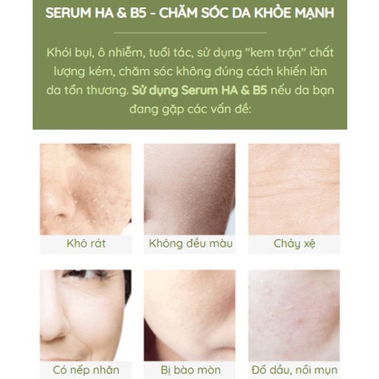 Bộ serum, kem dưỡng Lagumi cho da dầu, mụn với thành phần B5, Calendula, Super HA giảm mụn, cấp ẩm, sáng da mua 1 tặng 1