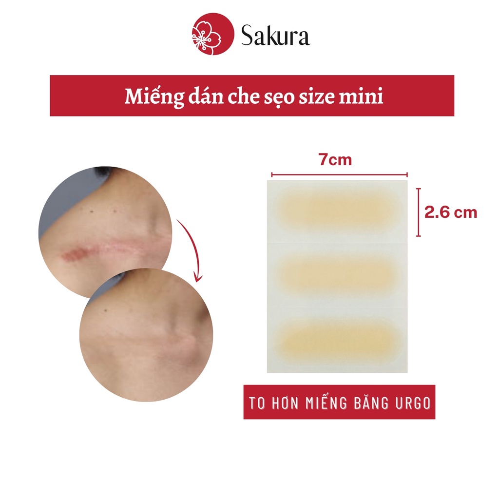 Miếng dán sẹo Japan Sakura Urgo 2,6x7cm miếng dán che khuyết điểm chống nước nhiều màu nhiều size