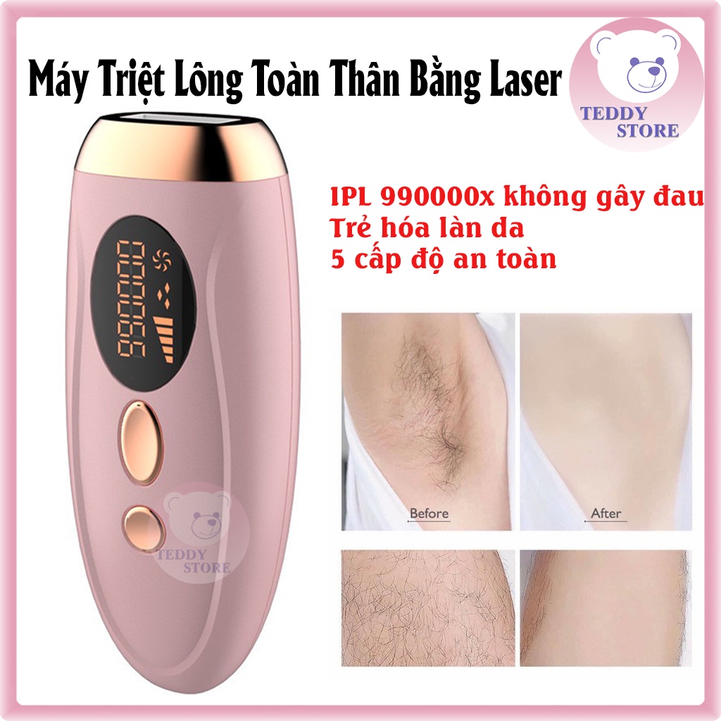 Máy Triệt Lông ToànThân Laser IPL 990000x  Không Gây Đau,  - Máy Triệt Lông Mini cầm tay