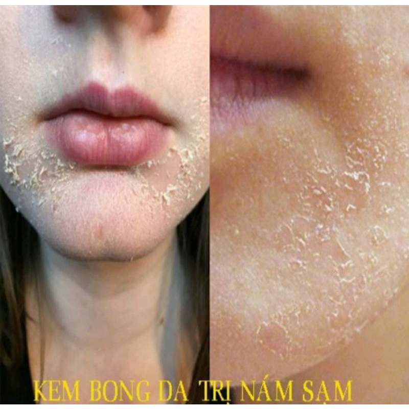 Kem vỗ bong da mặt BEZY ThaiLan