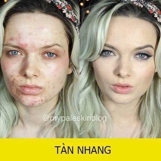 Che Khuyết Điểm Dermacod