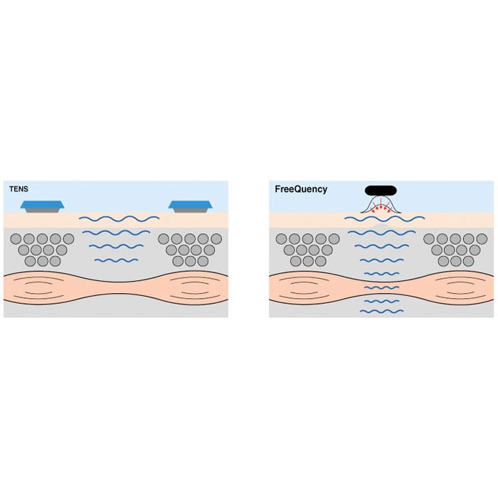 Máy massage bụng Buheung MK-207