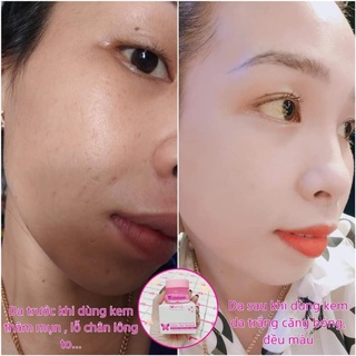 [CHÍNH HÃNG] KEM FACE 2 TẦNG MYÔ